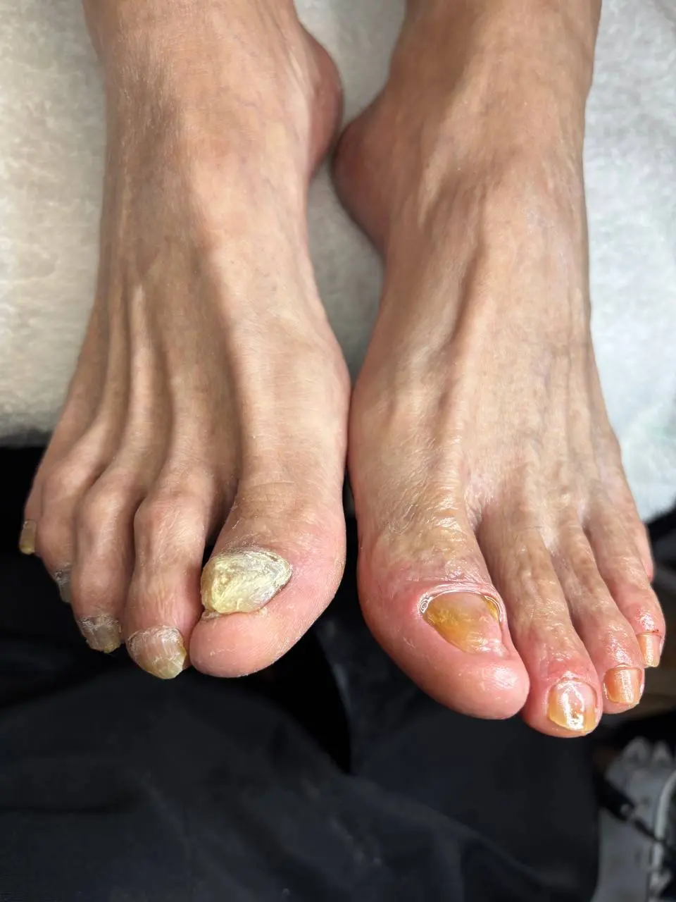 Medical pedicure assessment at NailLou Salon Spring Hill